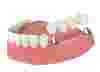 3d визуализация зубного моста