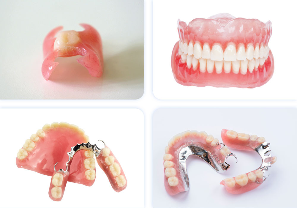 Полная имплантация - протезирование на имплантах при полном отсутствии зубов
